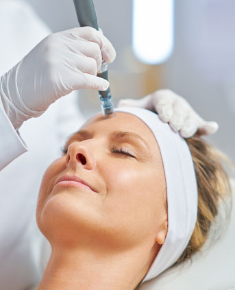 microneeddlding 1