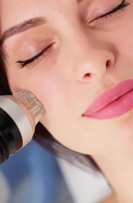 microneeddlding 2